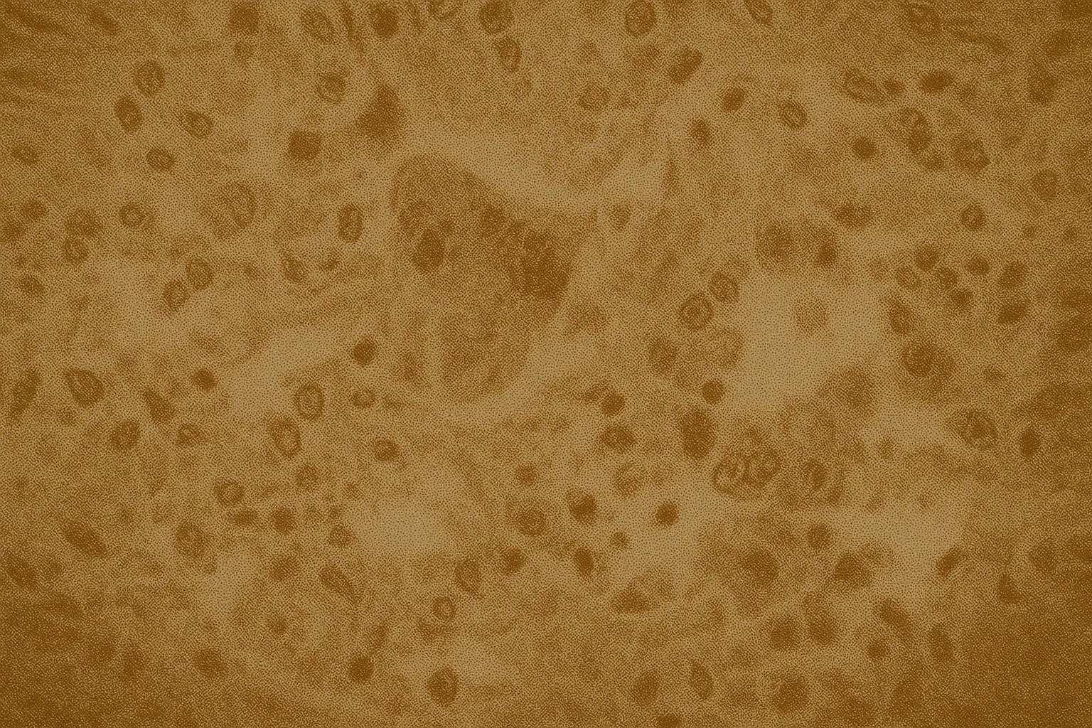 Canada Loses Measles Elimination Status After 5,000 Cases Across Nine Provinces