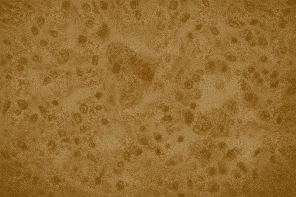 Canada Loses Measles Elimination Status After 5,000 Cases Across Nine Provinces